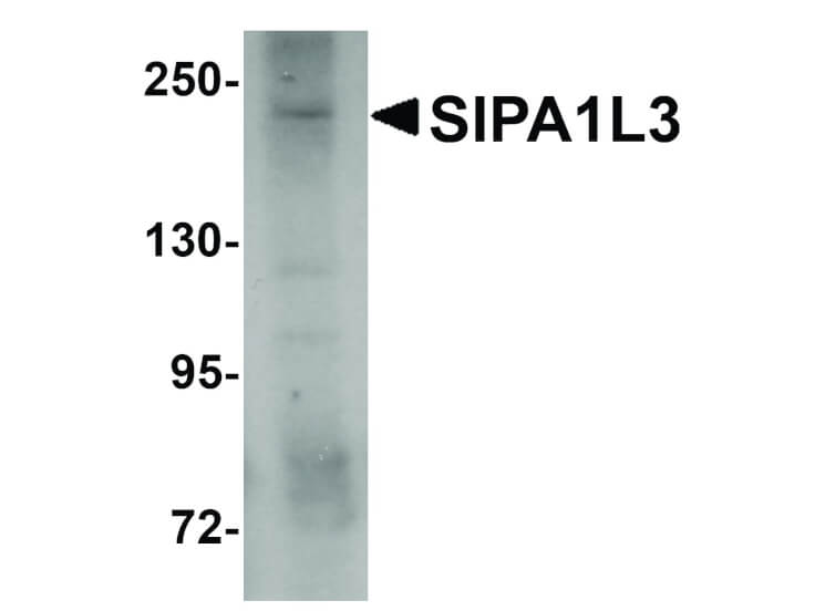 Western Blot of SIPA1L3 Antibody