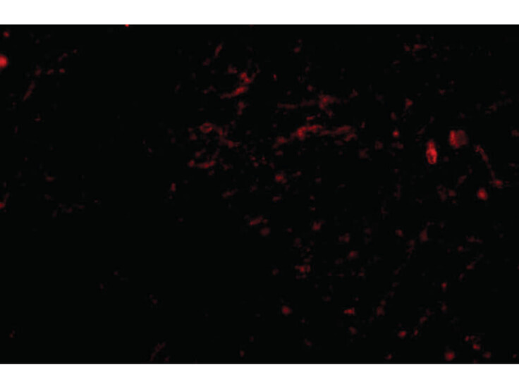 Immunofluorescence of SIRT2 Antibody