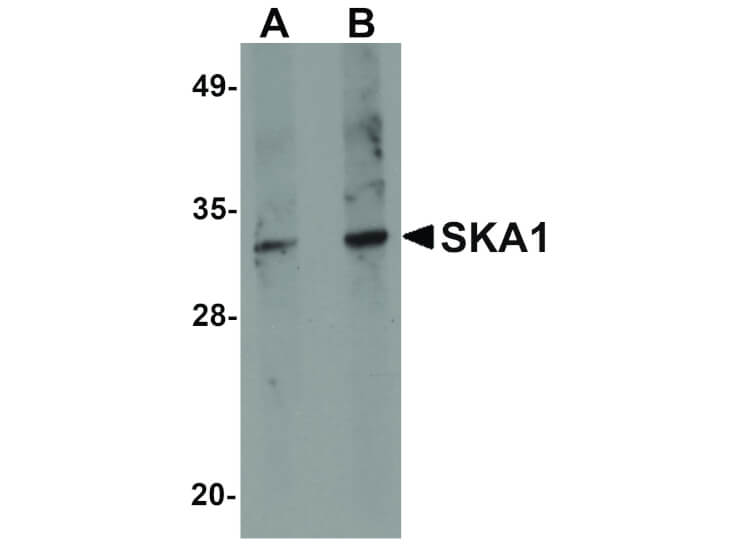 Western Blot of SKA1 Antibody