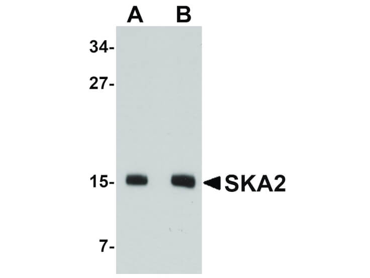 Western Blot of SKA2 Antibody