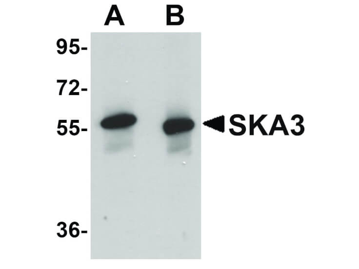 Western Blot of SKA3 Antibody