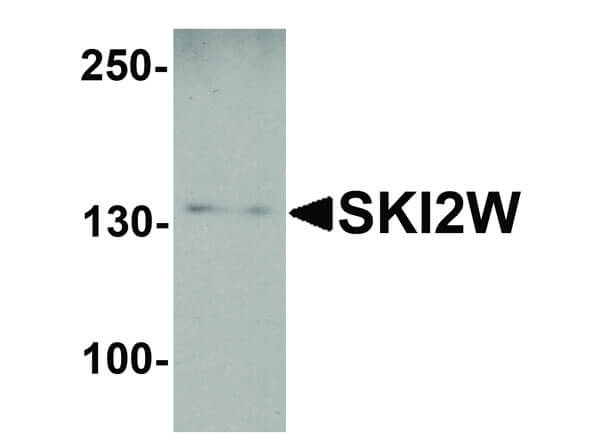 Western Blot of SKI2W Antibody
