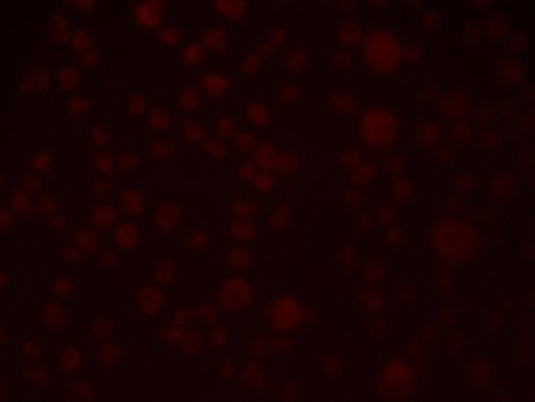 Immunofluorescence of SLAIN1