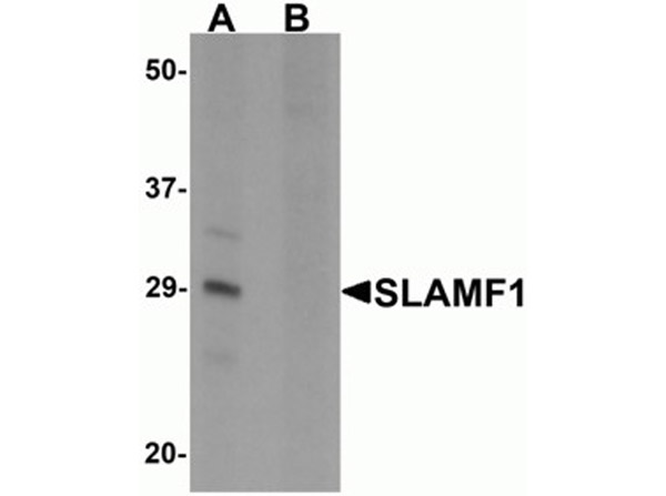 Western blot analysis of SLAMF1