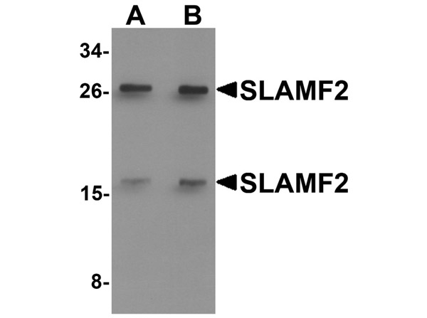 Western blot analysis of SLAMF2