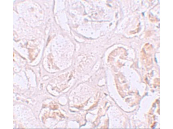 Immunohistochemistry of SLAMF9