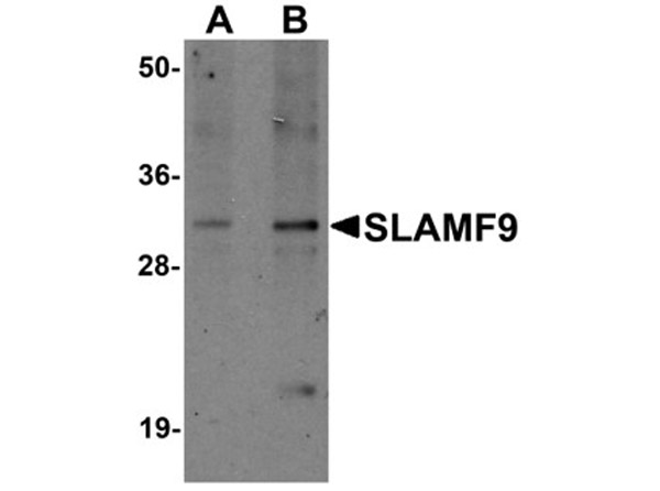 Western blot analysis of SLAMF9