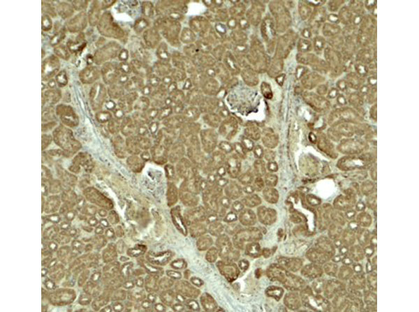 Immunohistochemistry of SLC1A7