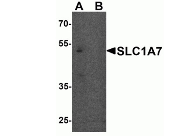 Western blot of SLC1A7