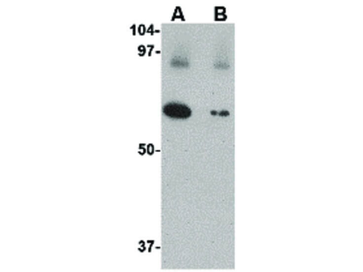 Western Blot of Slc22A17 Antibody