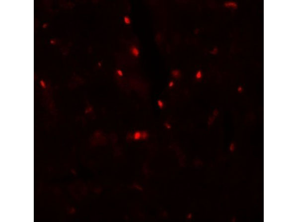 Immunofluorescence of SLC27A6
