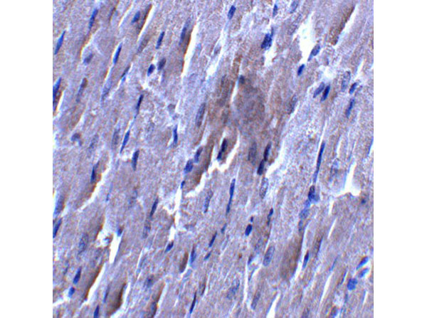Immunohistochemistry of SLC27A6