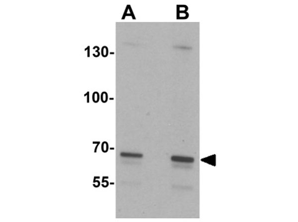 Western blot of SLC27A6