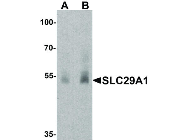 Western Blot of SLC29A1 Antibody