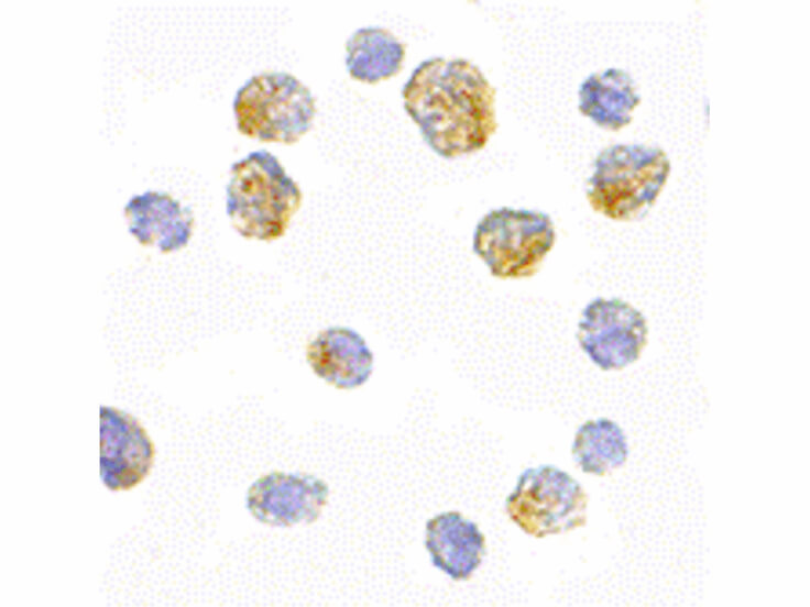 Immunocytochemistry of Slc35D1 Antibody
