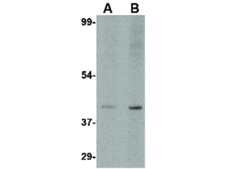 Western Blot of Slc35D1 Antibody