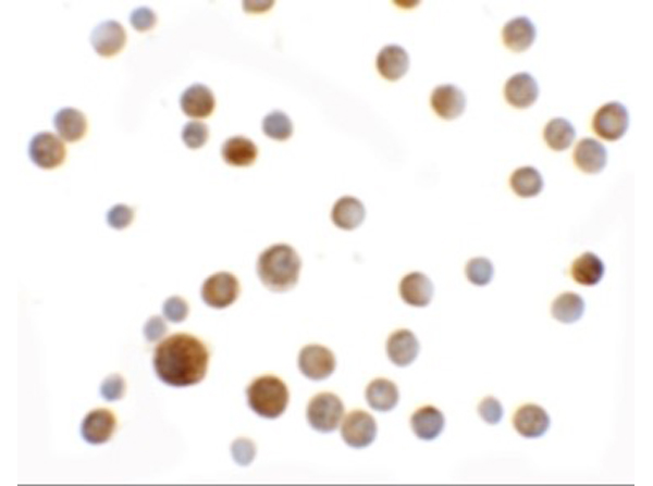 Immunocytochemistry of SLC35D2