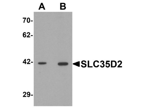 Western blot analysis of SLC35D2