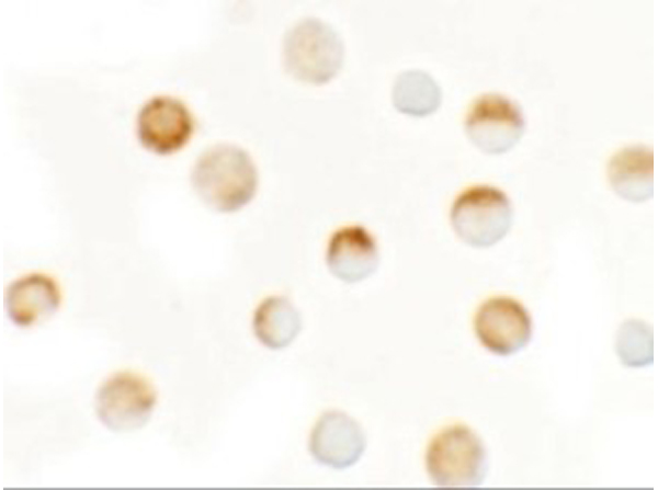 Immunocytochemistry of SLC35D3