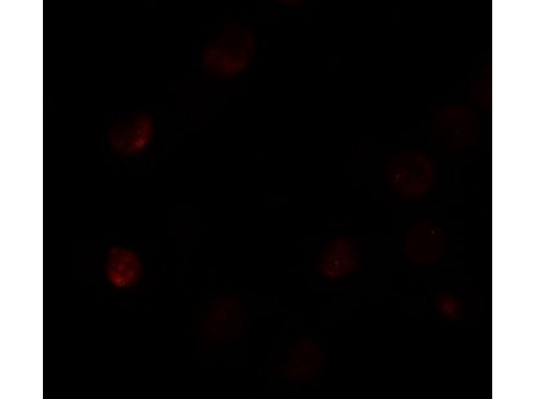 Immunofluorescence of SLC35D3
