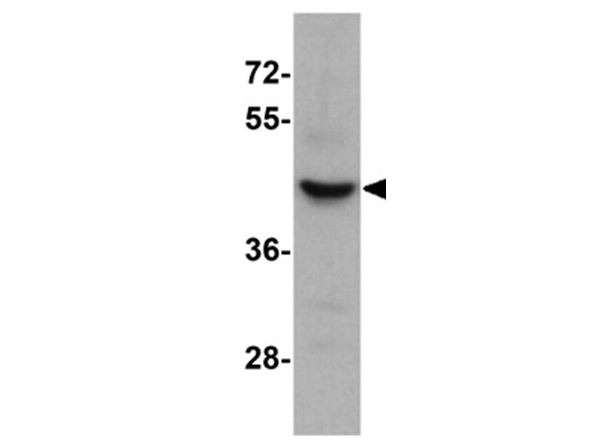 Western blot analysis of SLC35D3