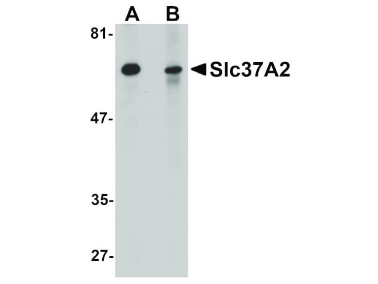 Western Blot of Slc37A2 Antibody