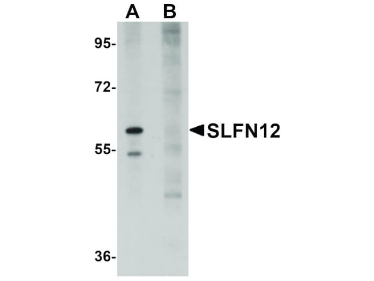 Western Blot of SLFN12 Antibody