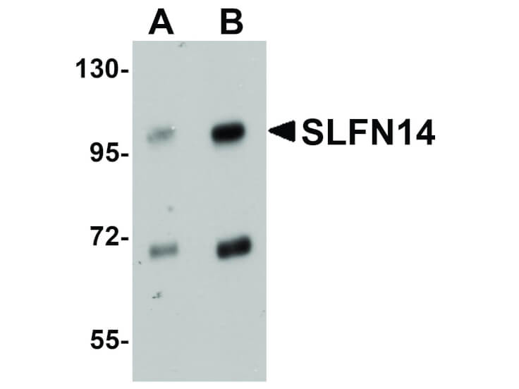 Western Blot of SLFN14 Antibody