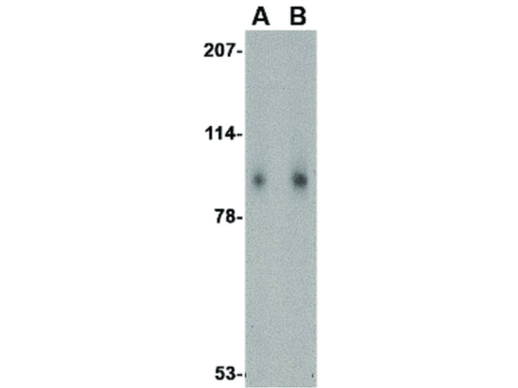 Western Blot of Slitrk1 Antibody