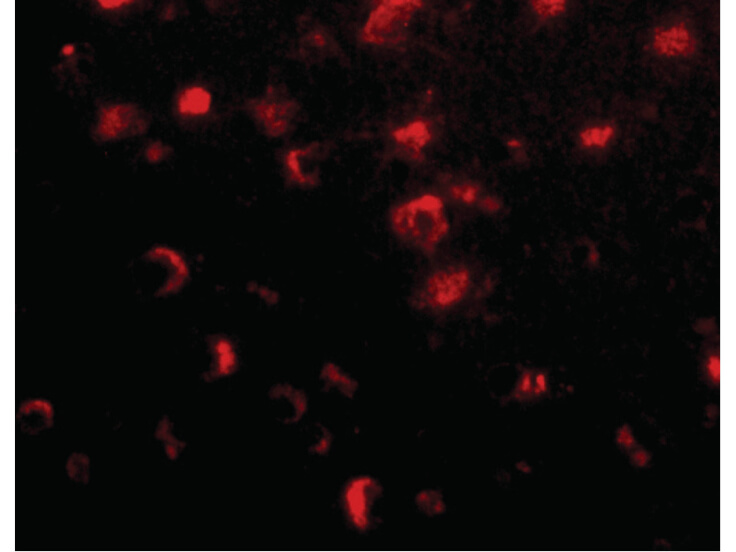 Immunofluorescence of Slitrk1 Antibody