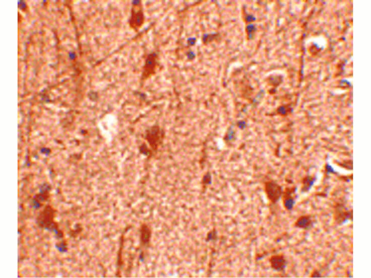 Immunohistochemistry of Slitrk3 Antibody