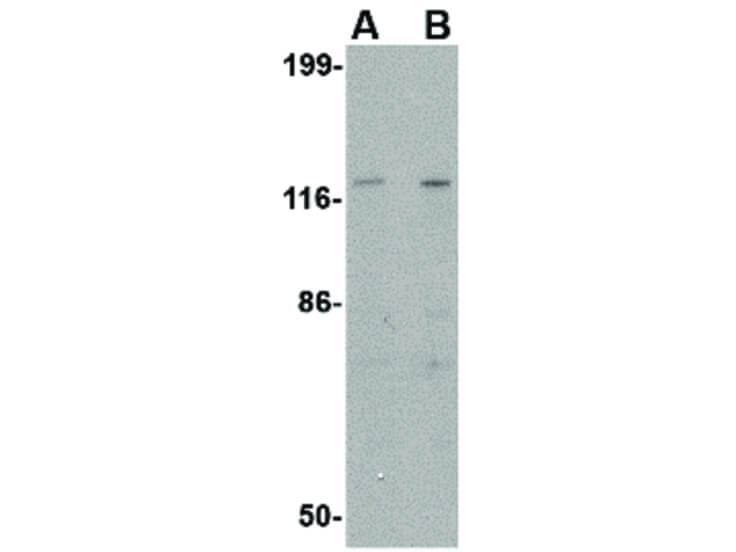 Western Blot of Slitrk3 Antibody