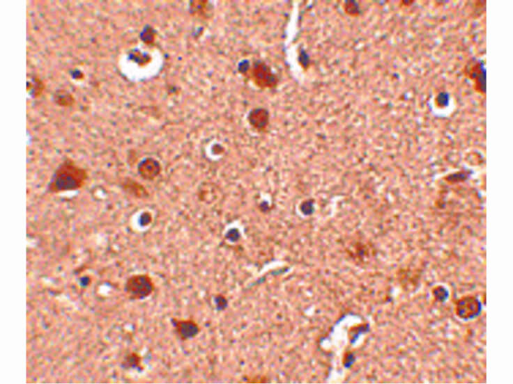 Immunohistochemistry of Slitrk4 Antibody