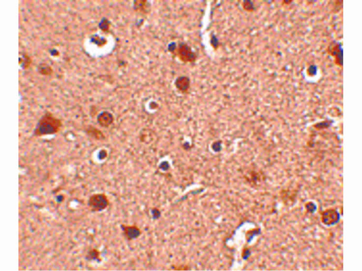 Immunohistochemistry of Slitrk4 Antibody