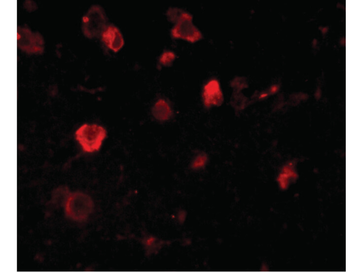 Immunofluorescence of Slitrk4 Antibody