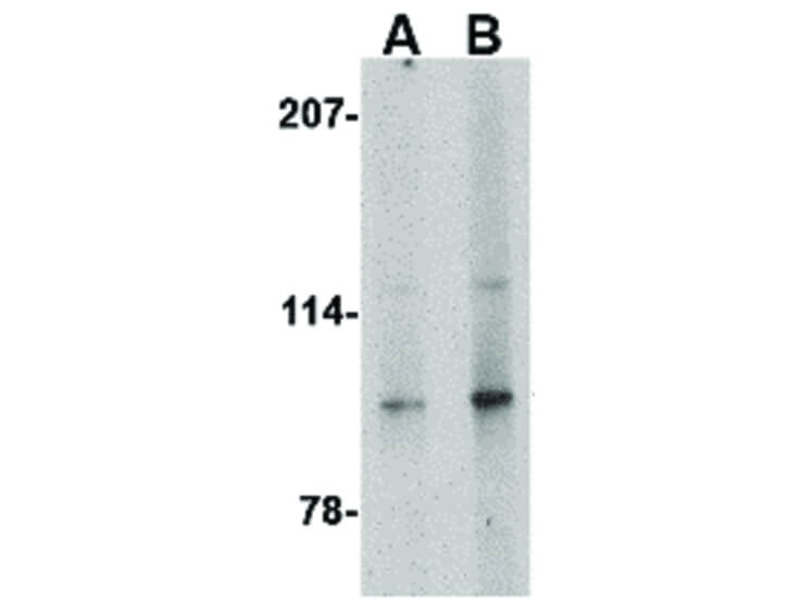 Western Blot of Slitrk4 Antibody