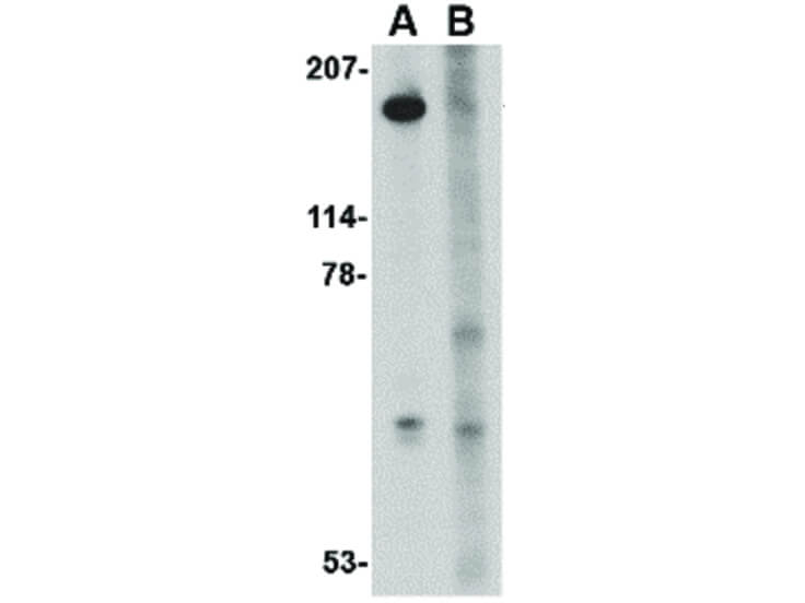 Western Blot of Slitrk5 Antibody