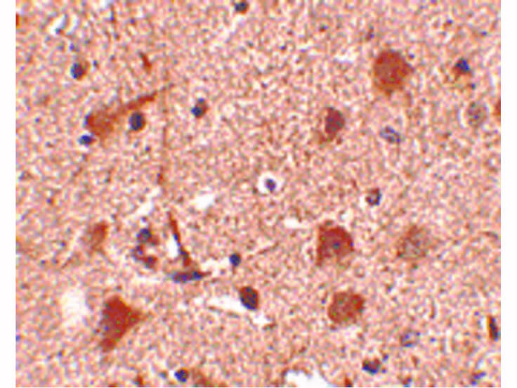 Immunohistochemistry of Slitrk5 Antibody