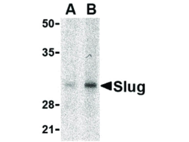 Western Blot of Slug Antibody
