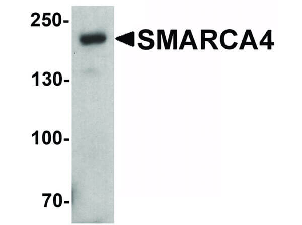 Western Blot of SMARCA4 Antibody