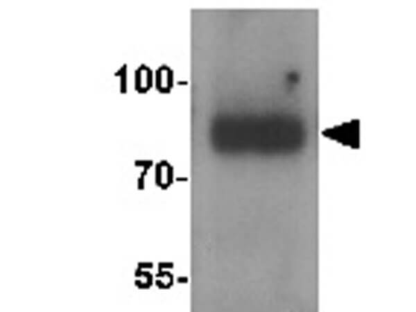 Western Blot of SMURF1 Antibody