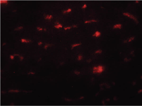 Immunofluorescence of SMURF2 Antibody