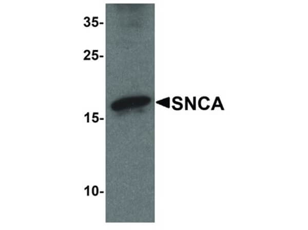Western Blot of SNCA Antibody