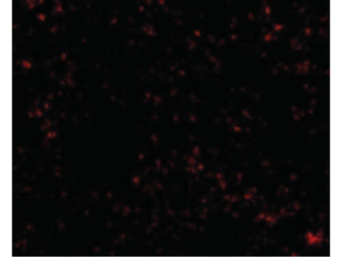 Immunofluorescence of SnoN Antibody