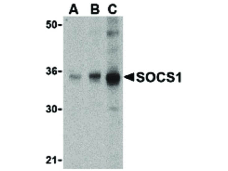 Western Blot of SOCS1 Antibody