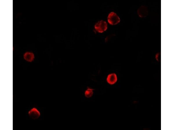Immunofluorescence of SOGA1