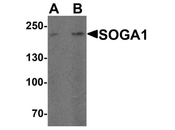 Western blot of SOGA1
