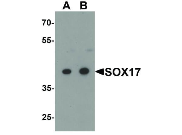 Western Blot of SOX17 Antibody