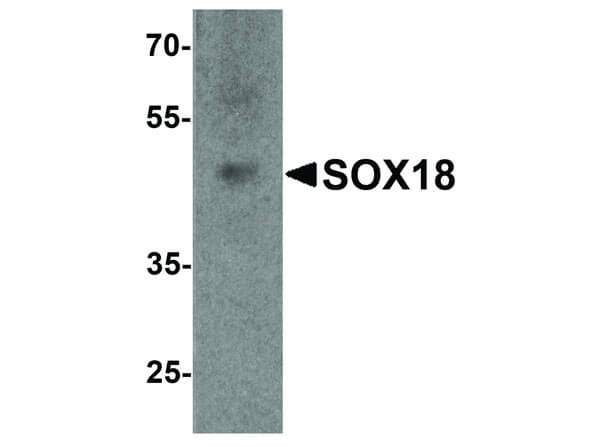 Western Blot of SOX18 Antibody