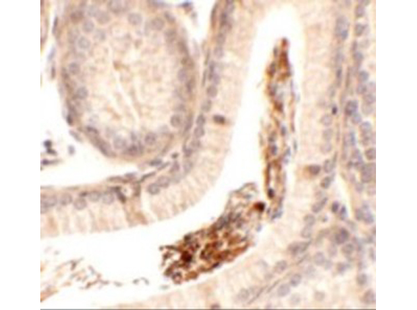 Immunohistochemistry of SPATA1